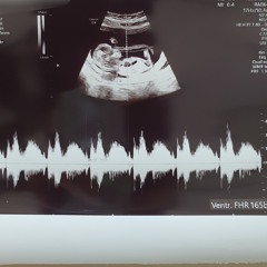 쉬소리(아기백색소음).mp3