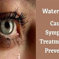 Best Swollen Watery Eyes Treatment Reviews