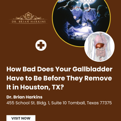 How Bad Does Your Gallbladder Have to Be Before They Remove It in Houston TX