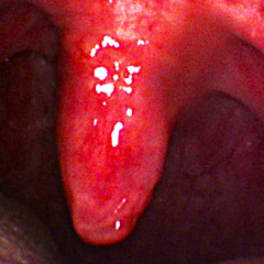 "Uvula" *SoundCloud Exclusive*