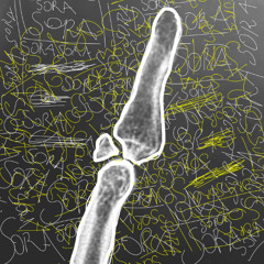 Chapter I - Broken Finger