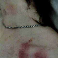 укус (zlodeyy11 luvmetonight)