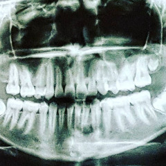 Take My Heart In Your Teeth And Run