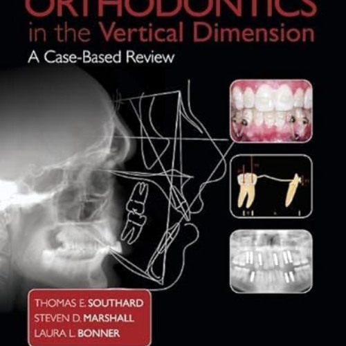 download EBOOK 📜 Orthodontics in the Vertical Dimension: A Case-Based Review by  Tho