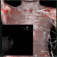 neuralLog1:: year 088 in hypersleep