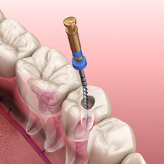 Root Canal Recovery: Tips for Easing Your Post-Procedure Pain