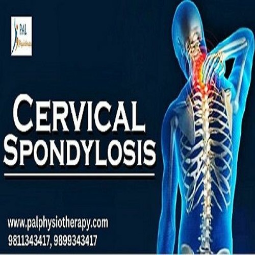 Stream Cervical Spondylosis Treatment In Gurgaon by Pal Physiotherapy ...