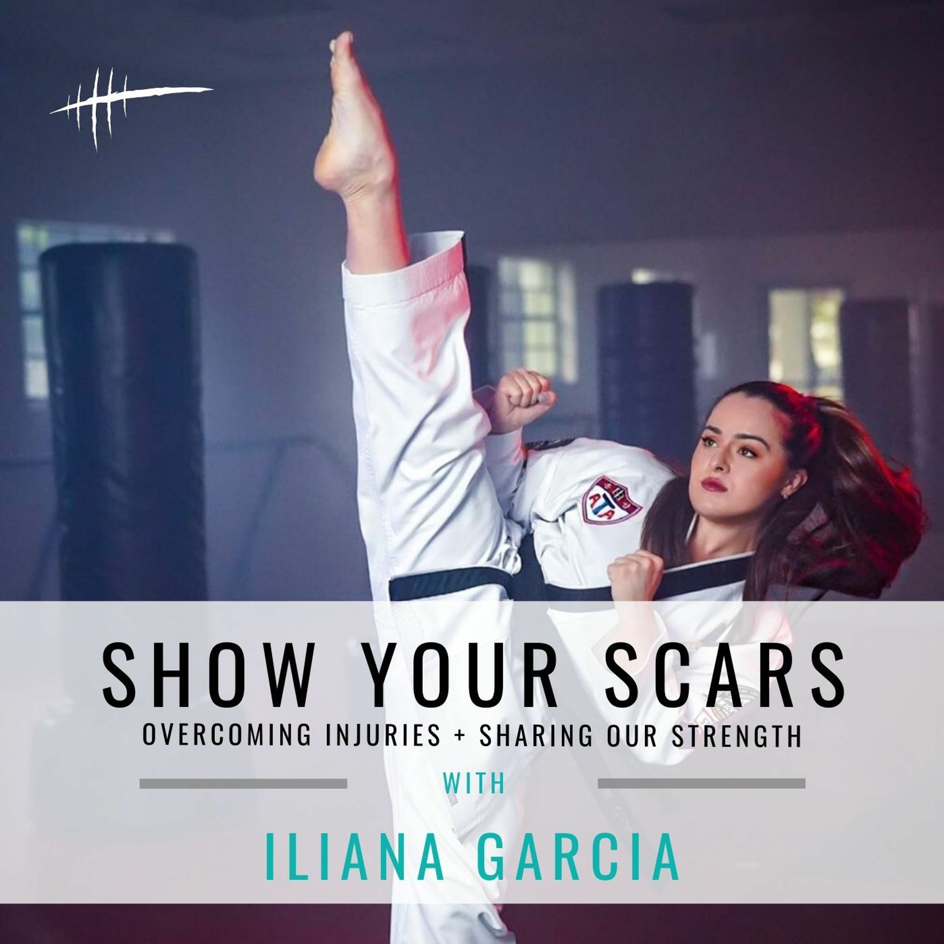Show Your Scars