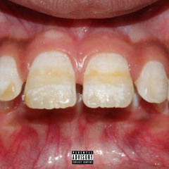 BUCKTOOTH