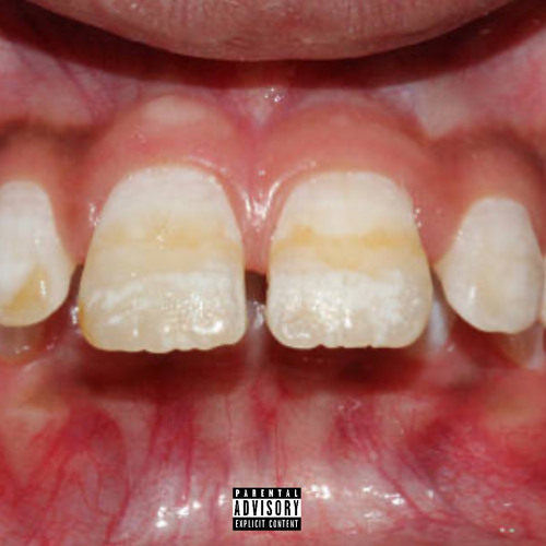 BUCKTOOTH