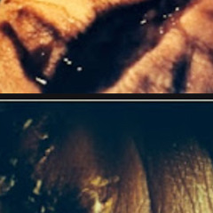 select A vein 10 3 2568