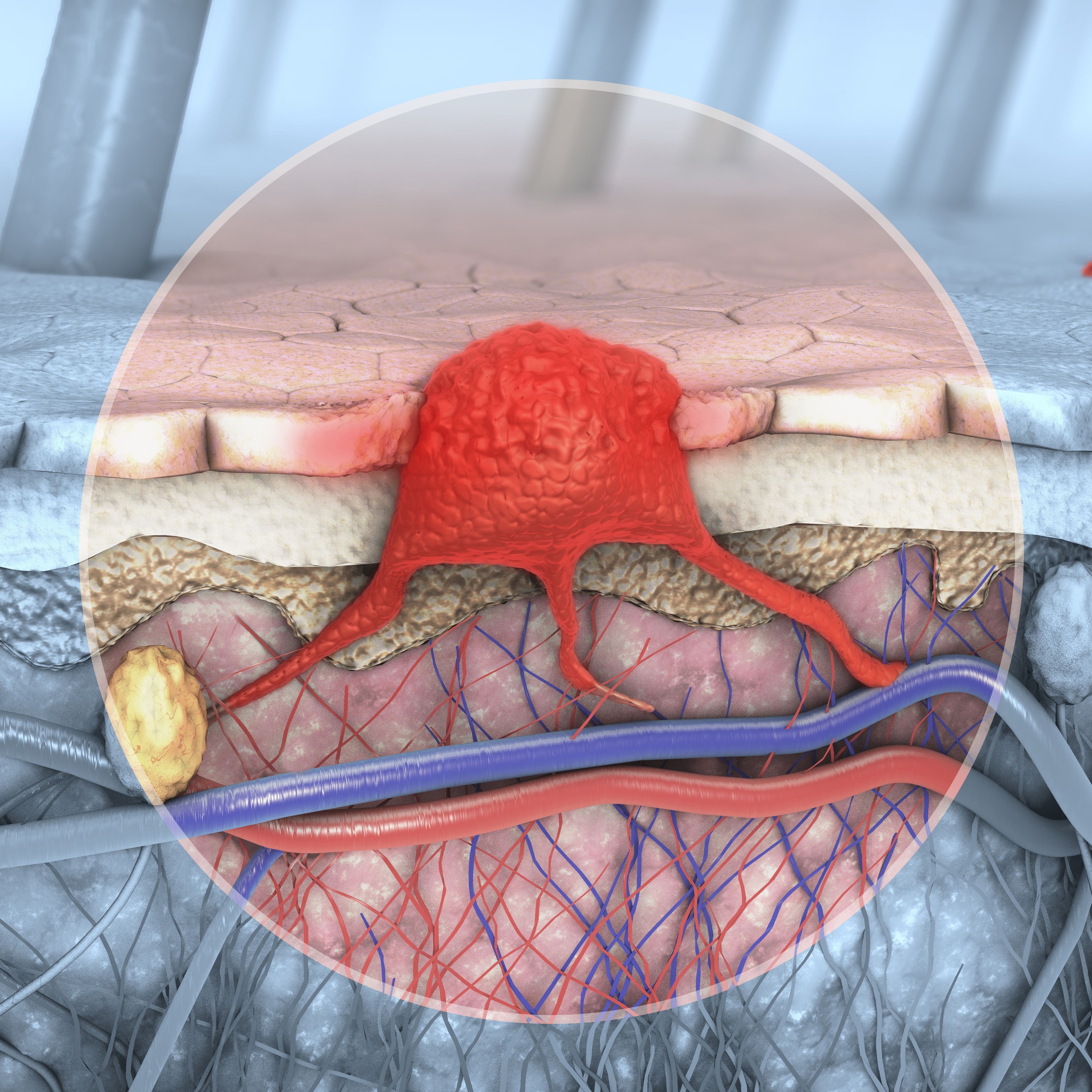 Oncotarget