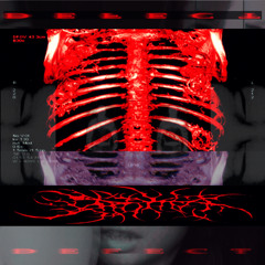 W1GOSS X TRPDVSR - HOTBOX