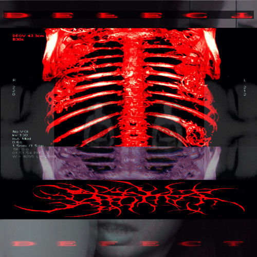 W1GOSS X TRPDVSR - HOTBOX