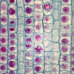 stages of mitosis