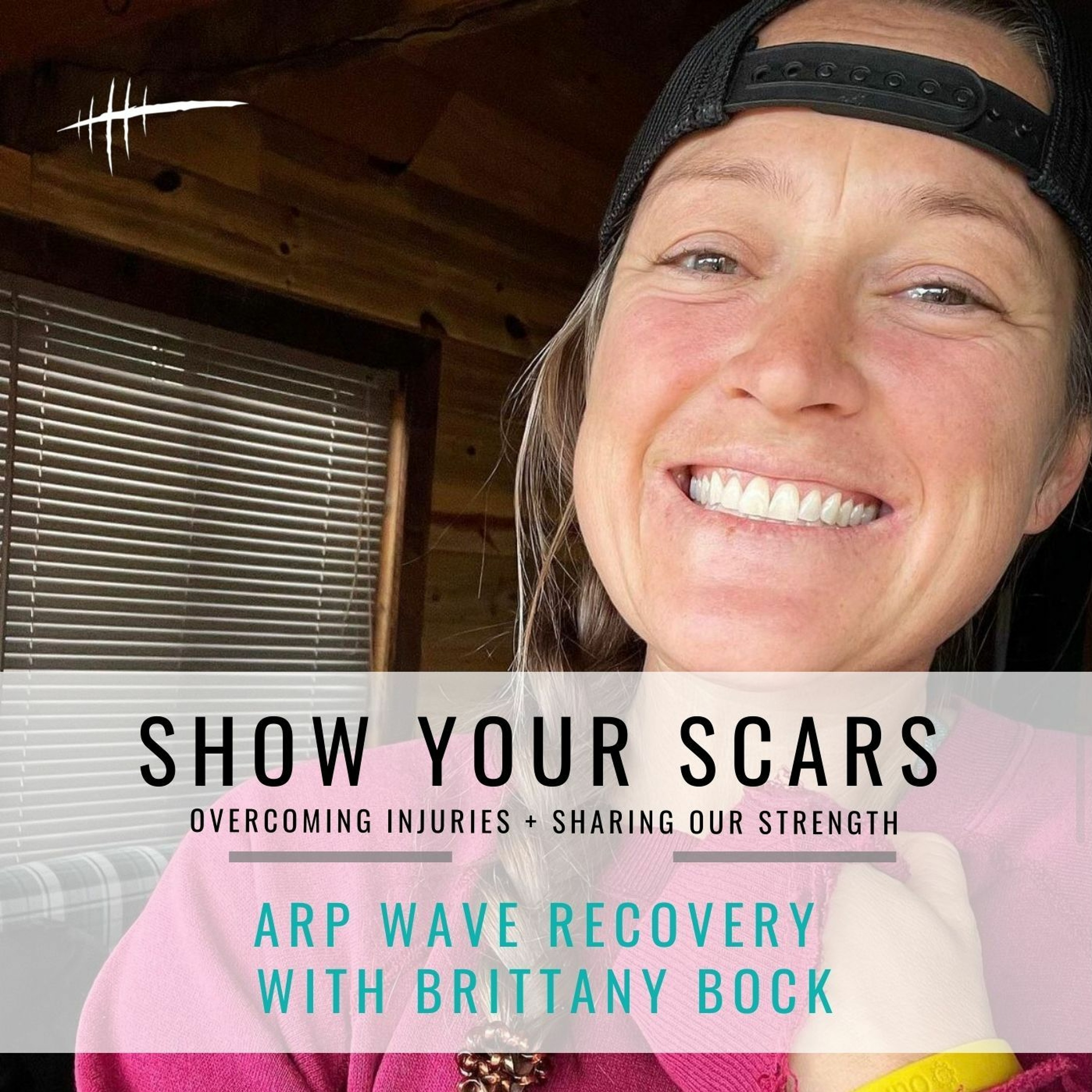 104: ARP Wave Treatment Series with Brittany Bock: Episode 1