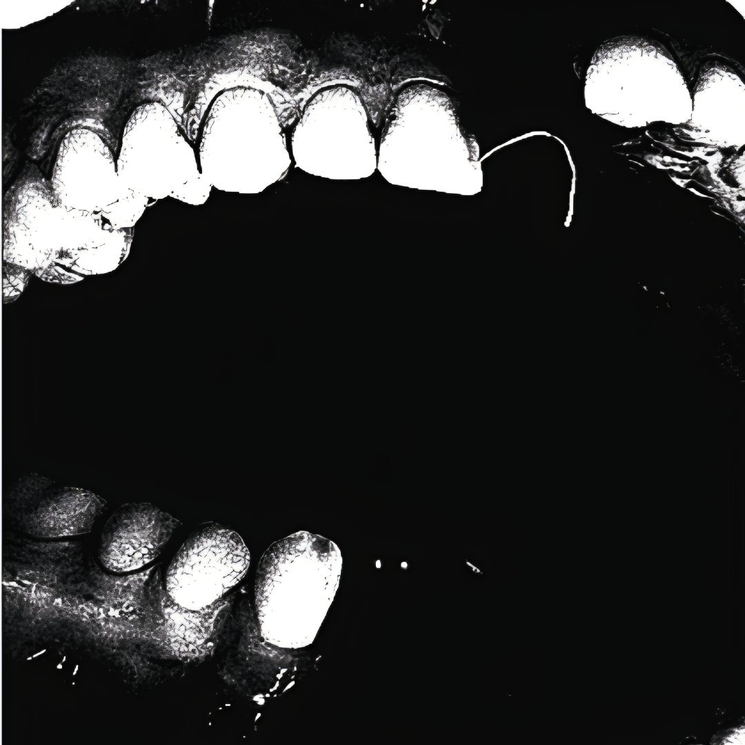 Loud Ringing Sound Stream LOUD NOISE by Phocomelia | Listen online for free on SoundCloud