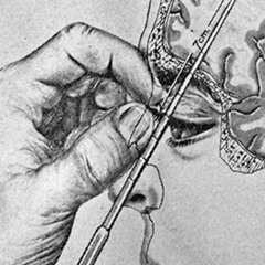 fentanyl enema
