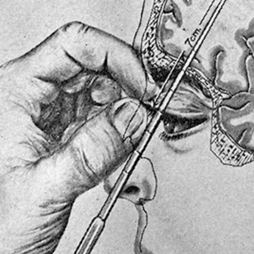 fentanyl enema