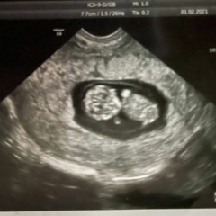 My Unborn Child