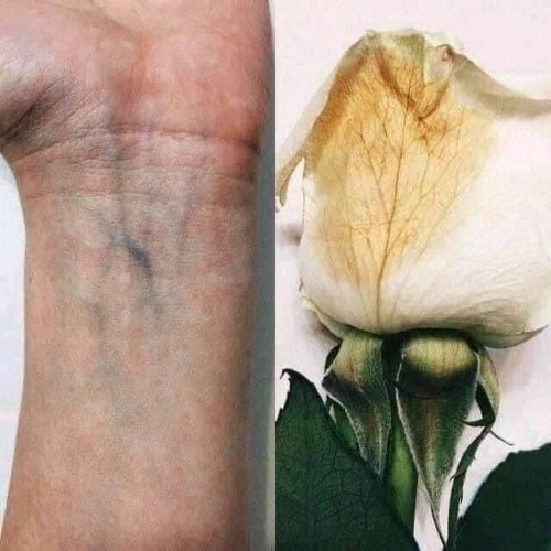 𝘋𝘰𝘱𝘦 𝘪𝘯 𝘮𝘺 𝘝𝘦𝘪𝘯𝘴 #𝘍𝘳𝘦𝘦𝘴𝘵𝘺𝘭𝘦