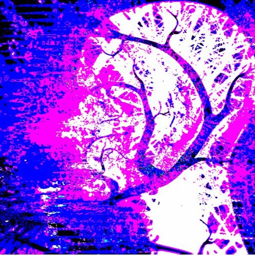 Trauma