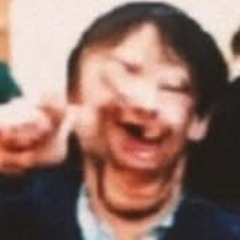 switch (prod.chxsen）