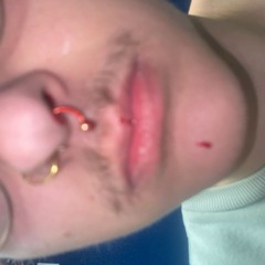 u found me pretty w nose bleeds?