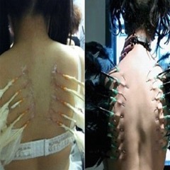 Snow Strippers - So What If I'm a Freak [hospital bed remix]