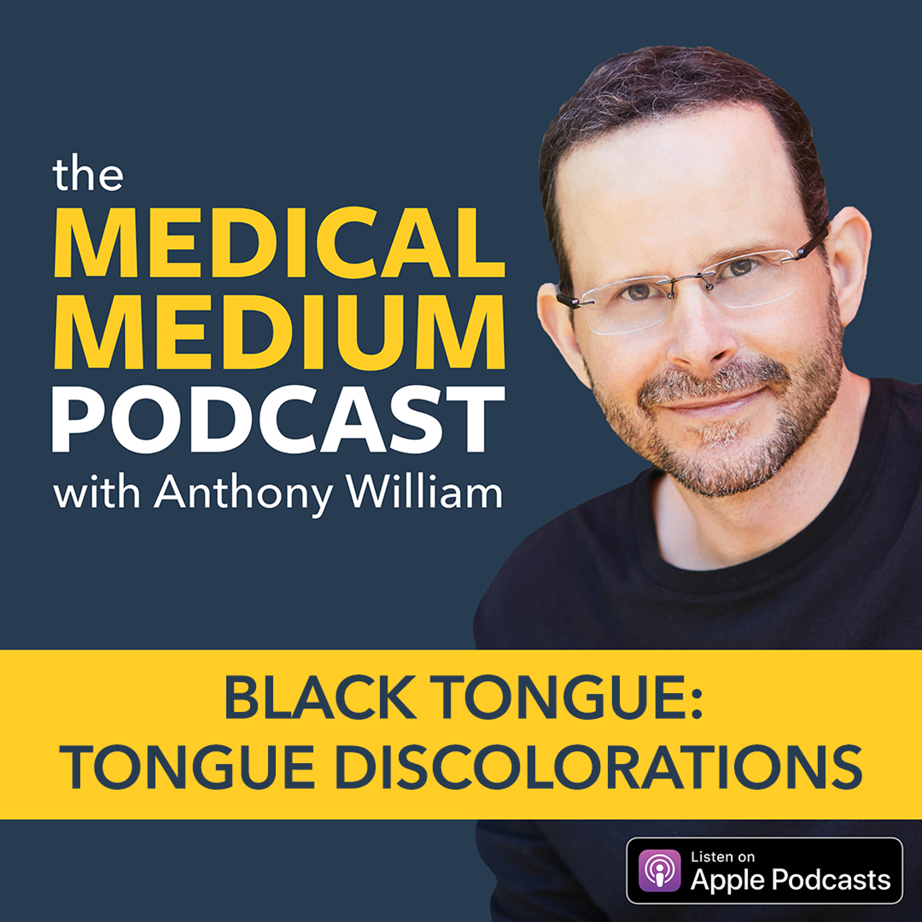 044 Black Tongue: Tongue Discoloration