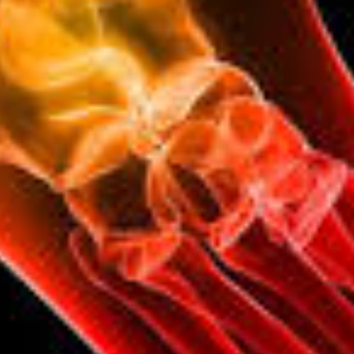 Neuropathy