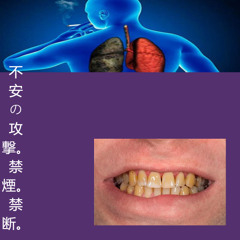 不安の攻撃。禁煙。禁断。(No smoking.)