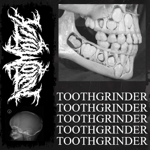 TOOTHGRINDER (INTERVAL AUDIO)
