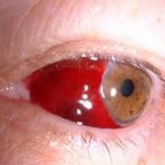 blood