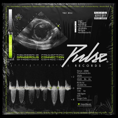 Juan Trujillo - Molecular Implant (Original Mix)