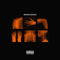 broken bones