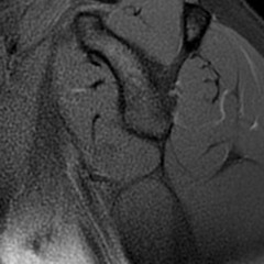 Buğra/Beta-Deli Dahi