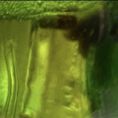 SOMETIMESYOUSTEPONTHEM-/\|~<>2.1.0-KIDEXX