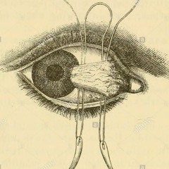 eye need permission