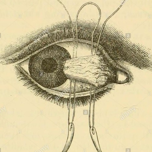 eye need permission