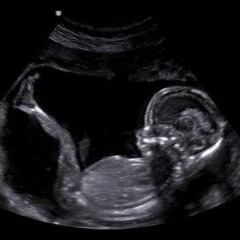 ultrasounds
