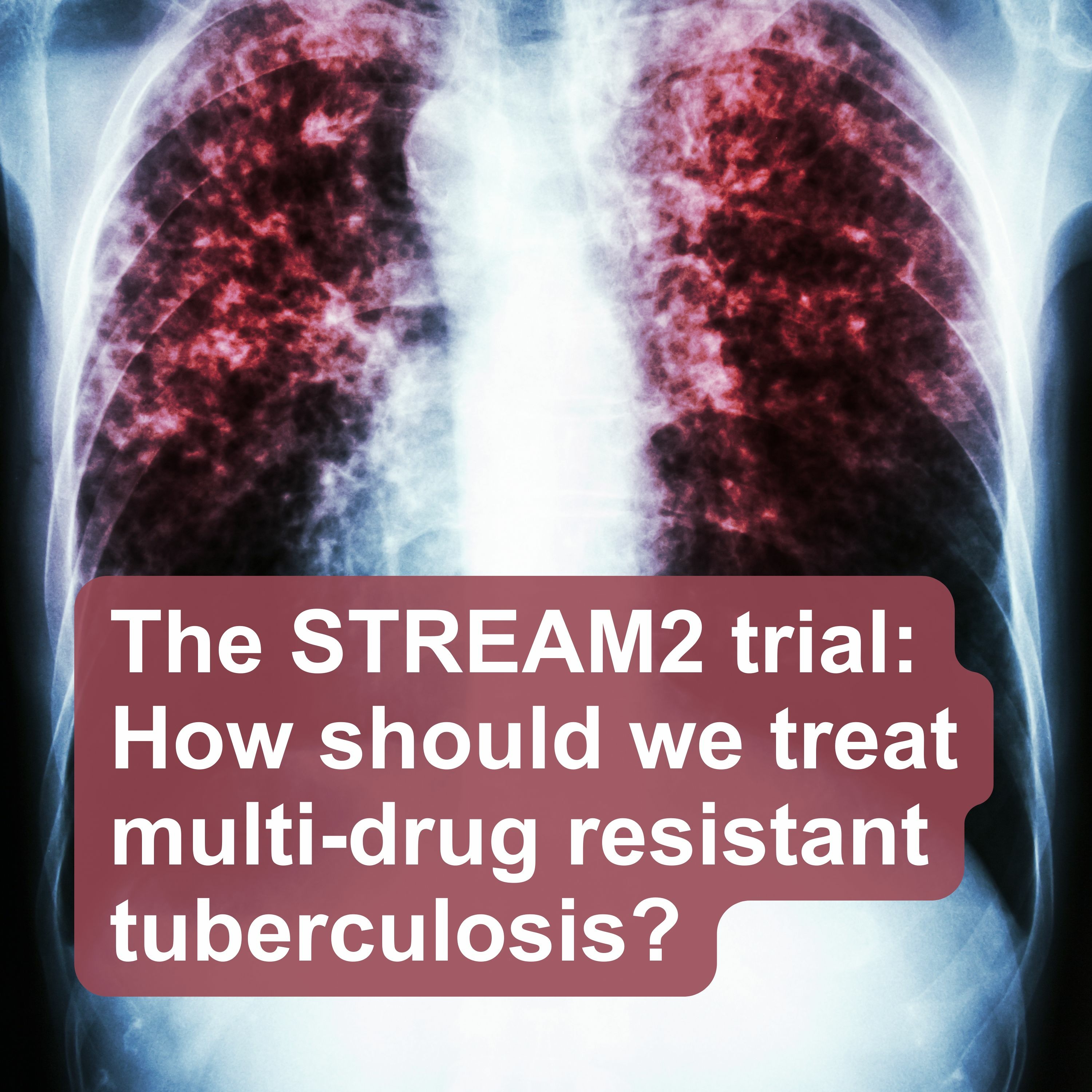 MRC CTU Podcasts