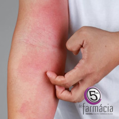 5 Minutos de Farmácia - 20Jun25 - Fotossensibilidade induzida por medicamentos - Pedro Faustino
