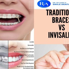 Best Invisible Aligner Treatment in Faridabad at Affordable Cost