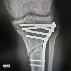 BR [Prod.Sepehr, MV]