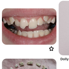 se me caen los dientes de tanto mentirme.mp3