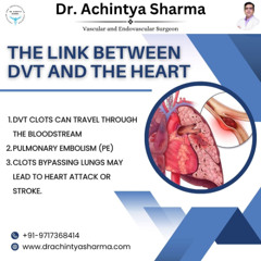 DVT and Heart Attack: What’s the Link?