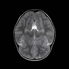 ÜLTRA EXPERIMENTAL MIND