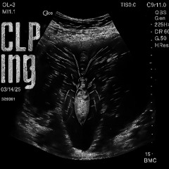 clipping. - Dodger (Breakmaster Cylinder remix)