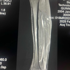 maybewecoulddoit2 (fjasper + #quinncullen)